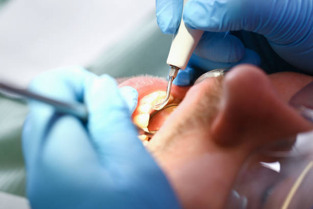 Best Broken or Cracked Tooth Emergency Dentist in Dothan, AL